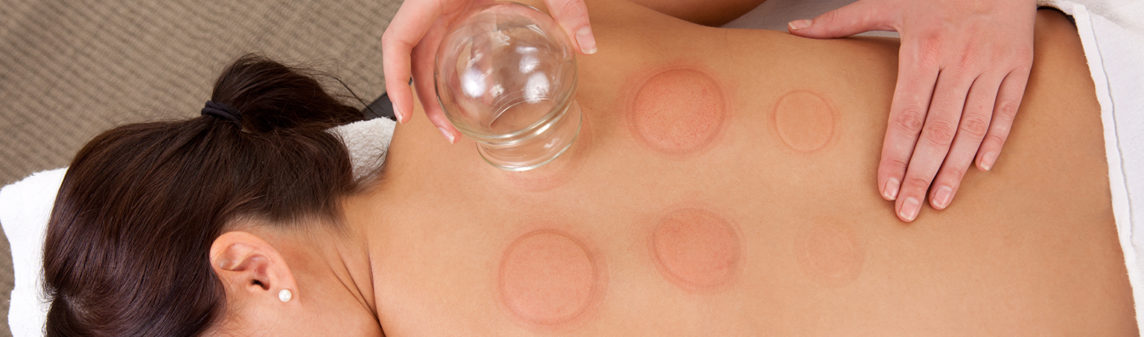 Cupping massage at Dubai's top spa, Yinyang