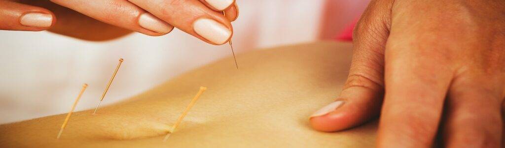 Acupressure treatment centre in Jumeirah Dubai.